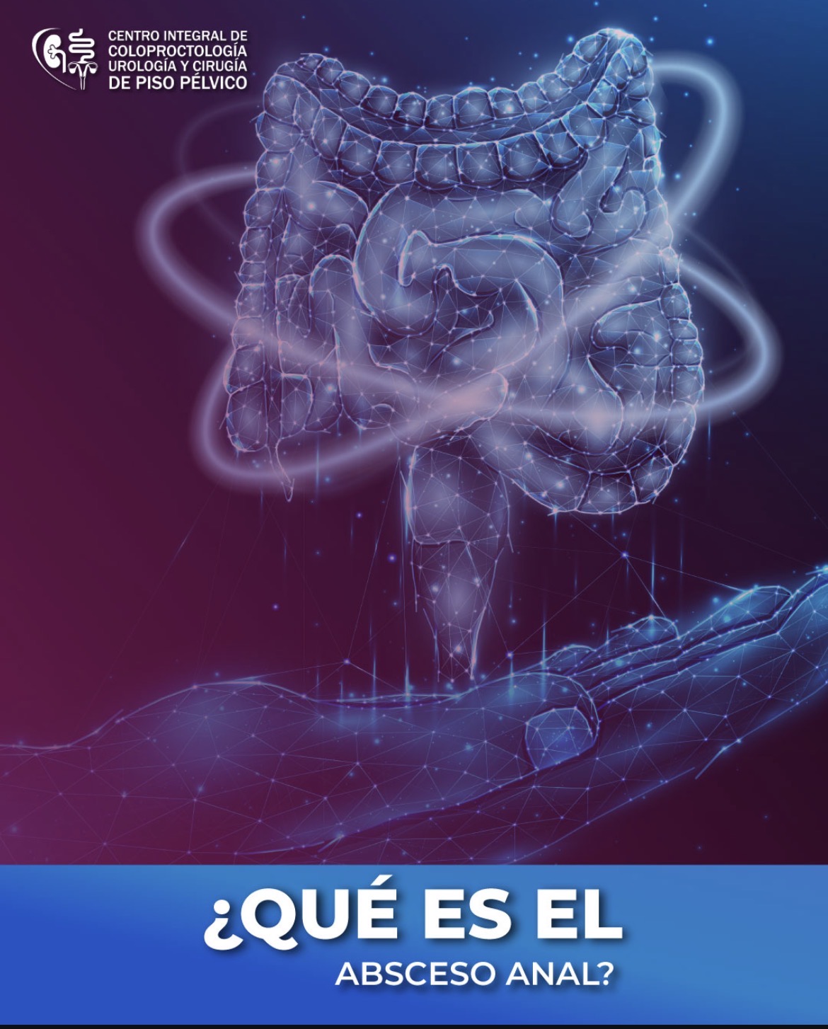Ilustración del intestino y región anorrectal relacionada con el absceso anal
