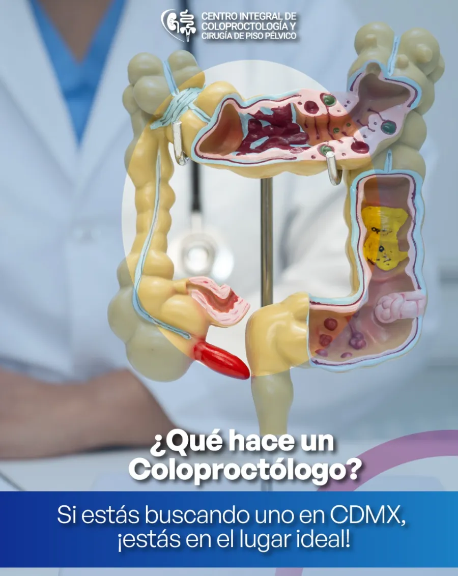 ¿Qué hace un coloproctólogo? Modelo anatómico del colon y recto